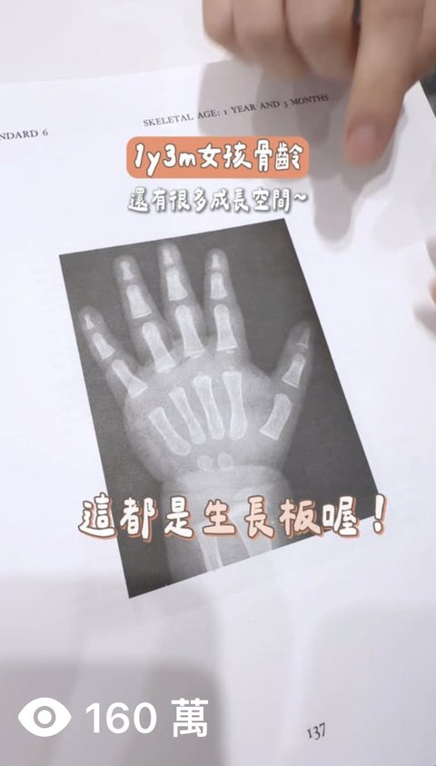 兒童成長門診 短影音，觀看 160萬
